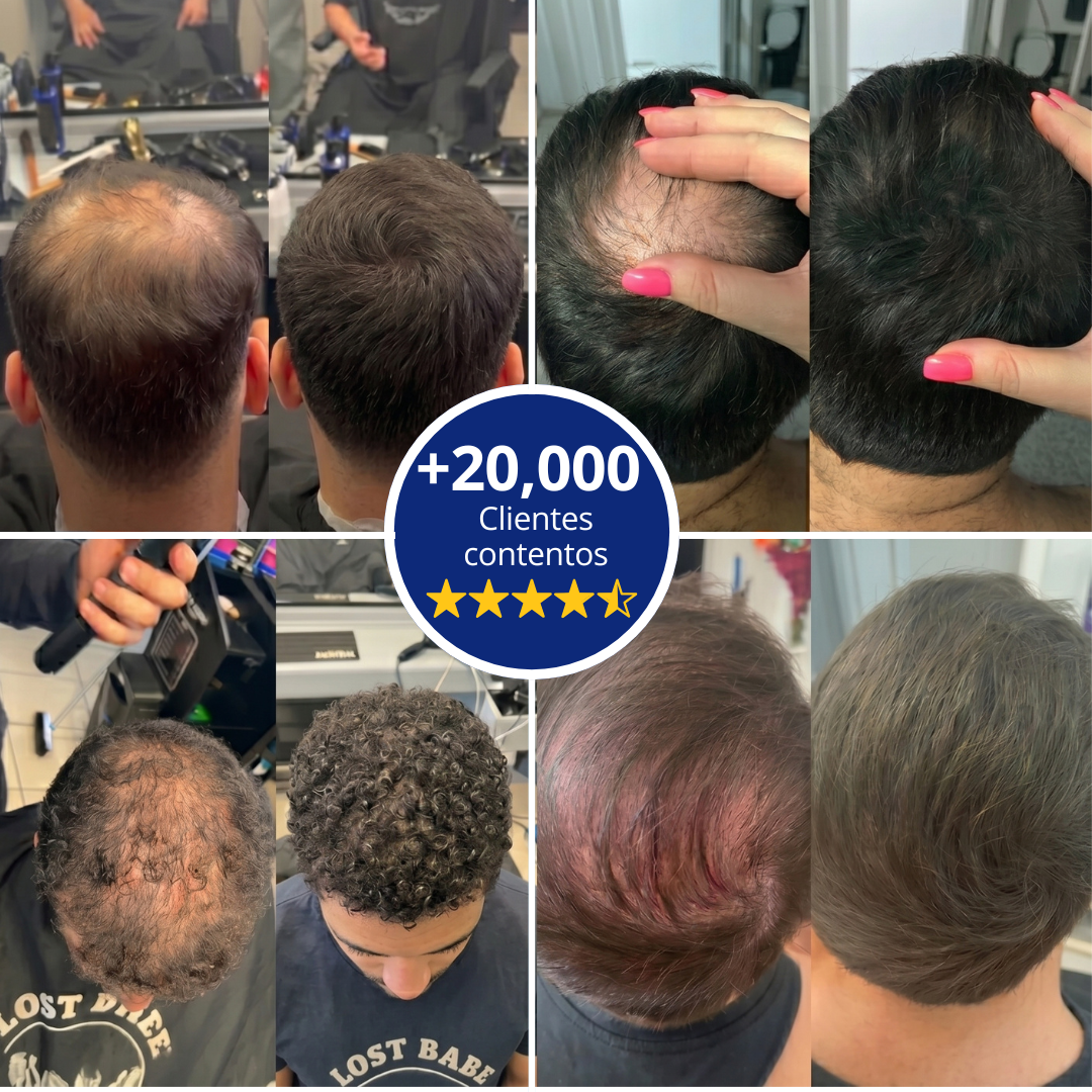 Haira™ - Densificador capilar