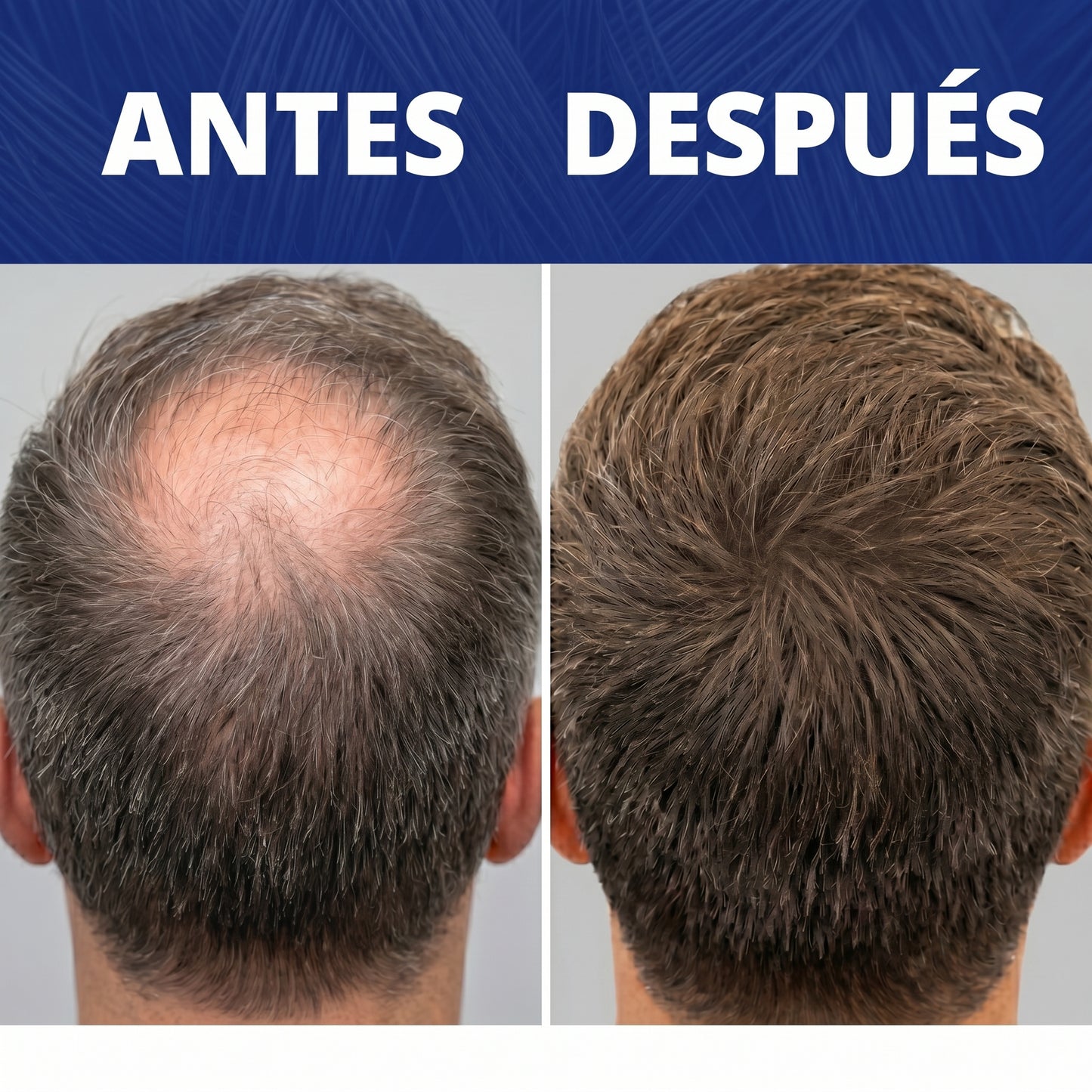 Haira™ - Densificador capilar