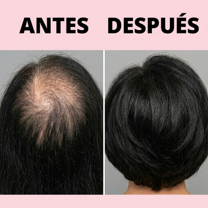 Haira™ - Cobertura Capilar